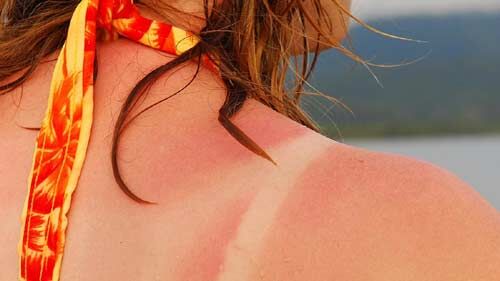 धूप में स्कीन का रखें ऐसे ख्याल, पढ़े पूरी खबर धूप में स्कीन का रखें ऐसे ख्याल, पढ़े पूरी खबर