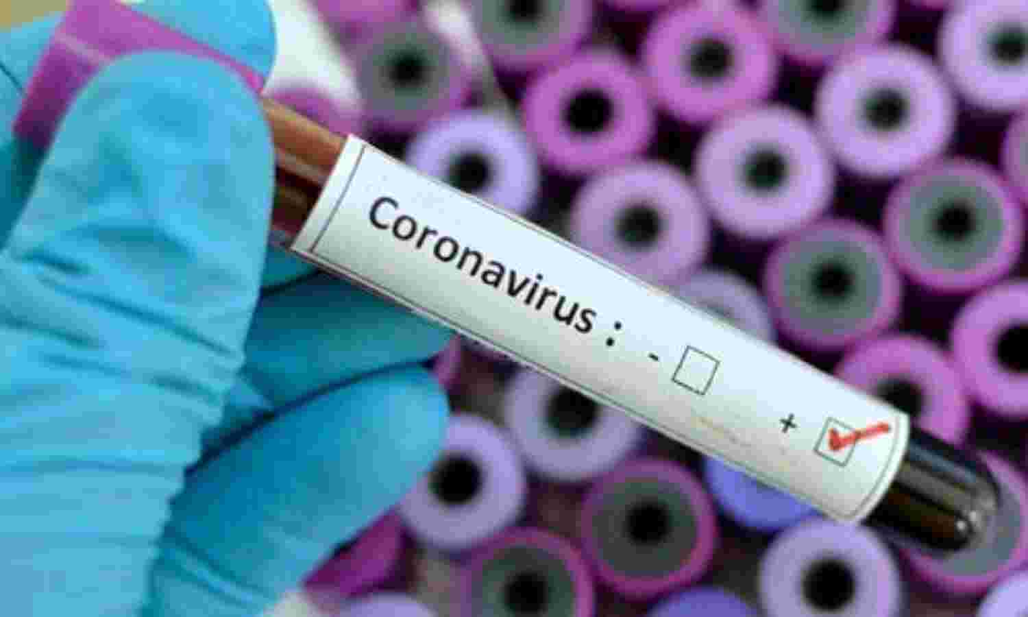 मप्र में मिला कोरोना का संदिग्ध मरीज, इलाज जारी