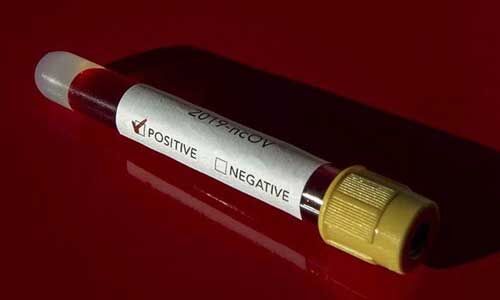 भारत में कोरोना के 24 घंटे में सामने आए 1486 नए केस, 49 की मौत