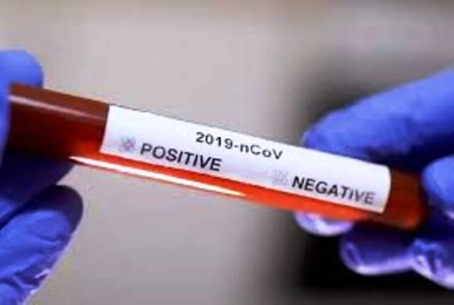 कोरोना कहर : स्वास्थ्य विभाग के 6 एवं 3 पुलिस कर्मियों की रिपोर्ट आई पॉजिटिव