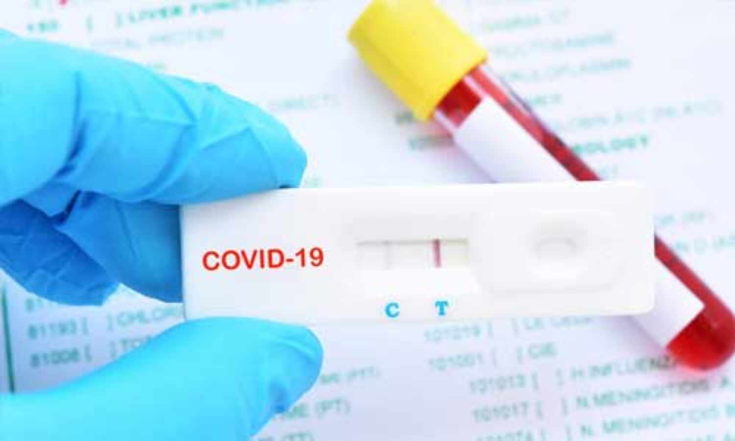 एंटी बॉडी टेस्ट के जरिये भारत अब कोरोना वायरस को मात देने की तैयारी में