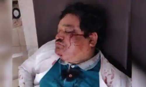 उप्र : मुरादाबाद में कोरोना वॉरियर्स संग क्या हुआ, जानें डॉक्टर की आपबीती उप्र : मुरादाबाद में कोरोना वॉरियर्स संग क्या हुआ, जानें डॉक्टर की आपबीती