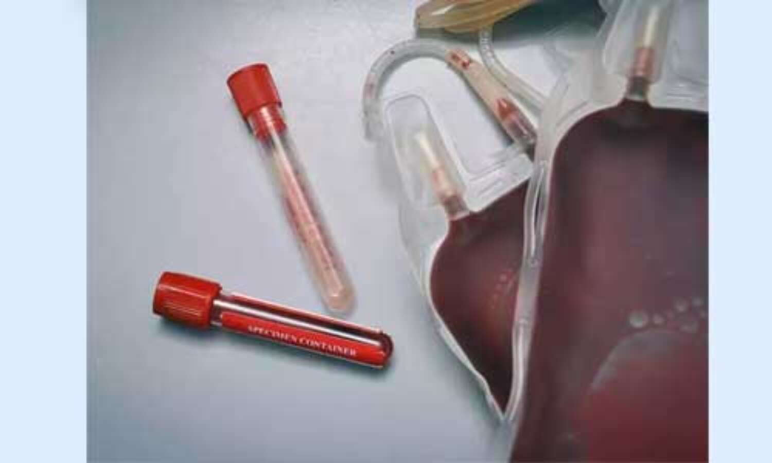 प्लाज्मा थेरेपी को लेकर स्वास्थ्य मंत्रालय ने कहा- अभी सबूत नहीं, ट्रायल के रूप में ही करें इस्तेमाल