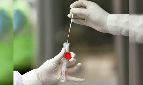 कोरोना की चपेट में एसएसबी के 13 जवान