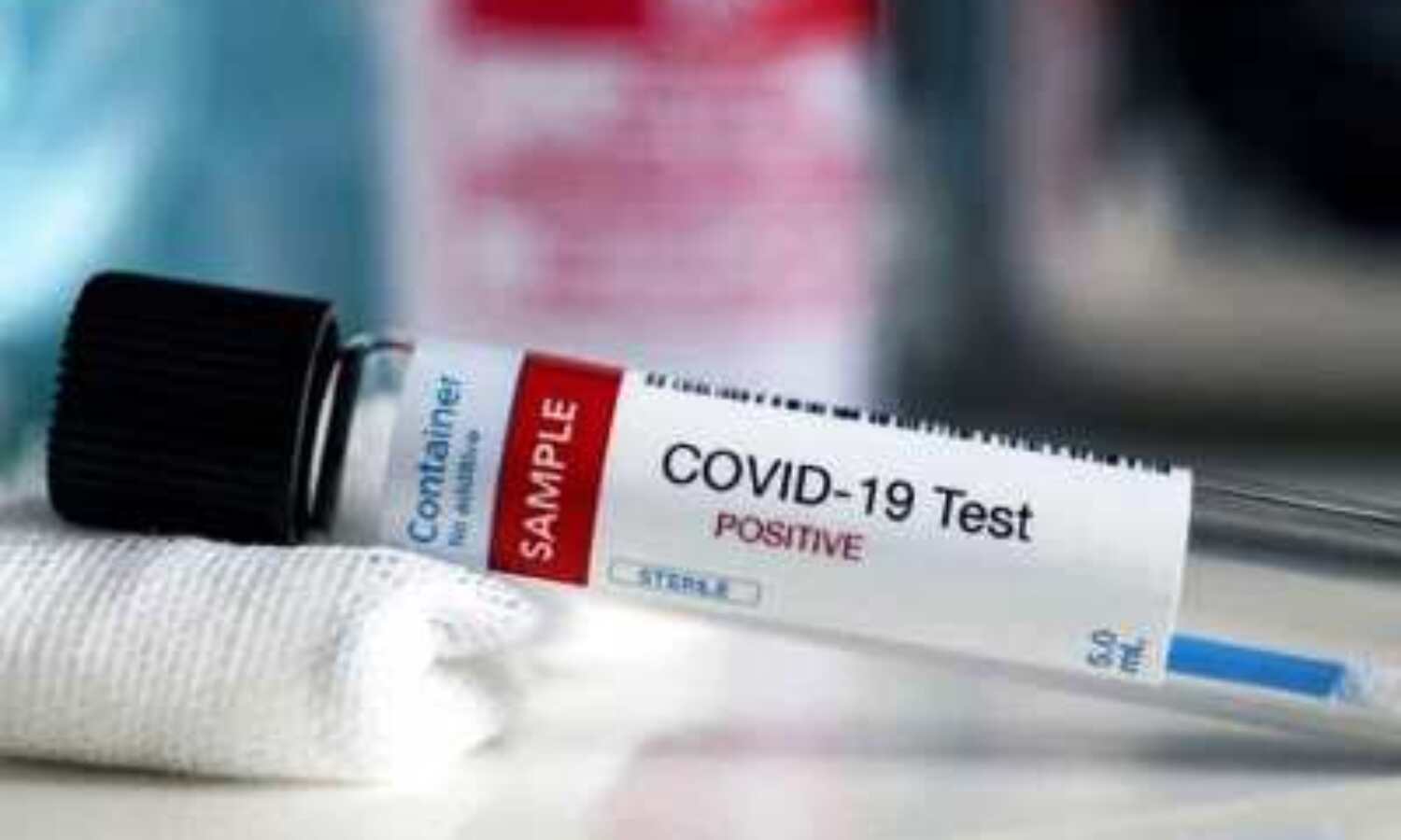 देश में कोरोना के 38,000 नए मामले, कुल संख्या 94.3 लाख के पार