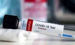 सीआरपीएफ का जवान मिला कोरोना पॉजिटिव