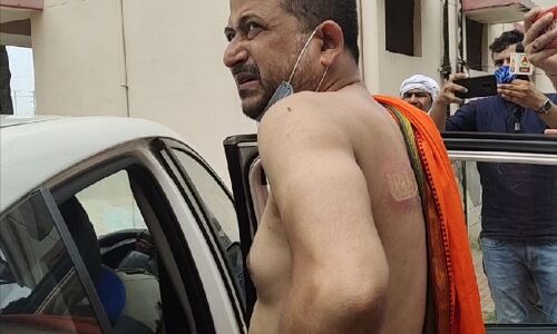 औरैया से अपहृत प्राॅपर्टी डीलर मथुरा में मिला, हाथ-पैर बांधकर फेंक गए थे बदमाश