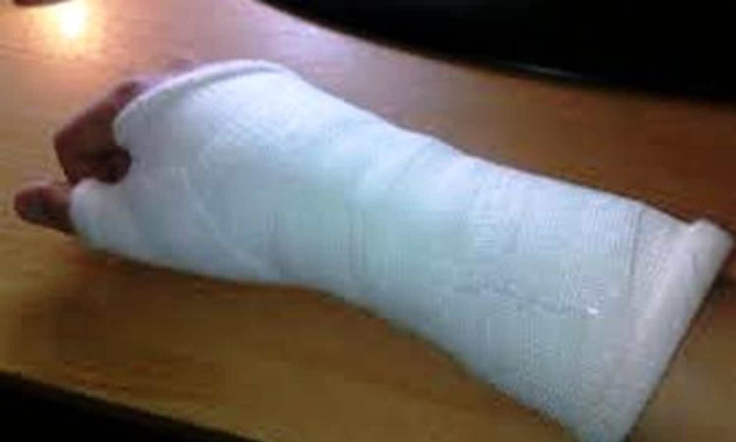 चिकित्सक की लापरवाही से टूटे हाथ, किया हंगामा चिकित्सक की लापरवाही से टूटे हाथ, किया हंगामा