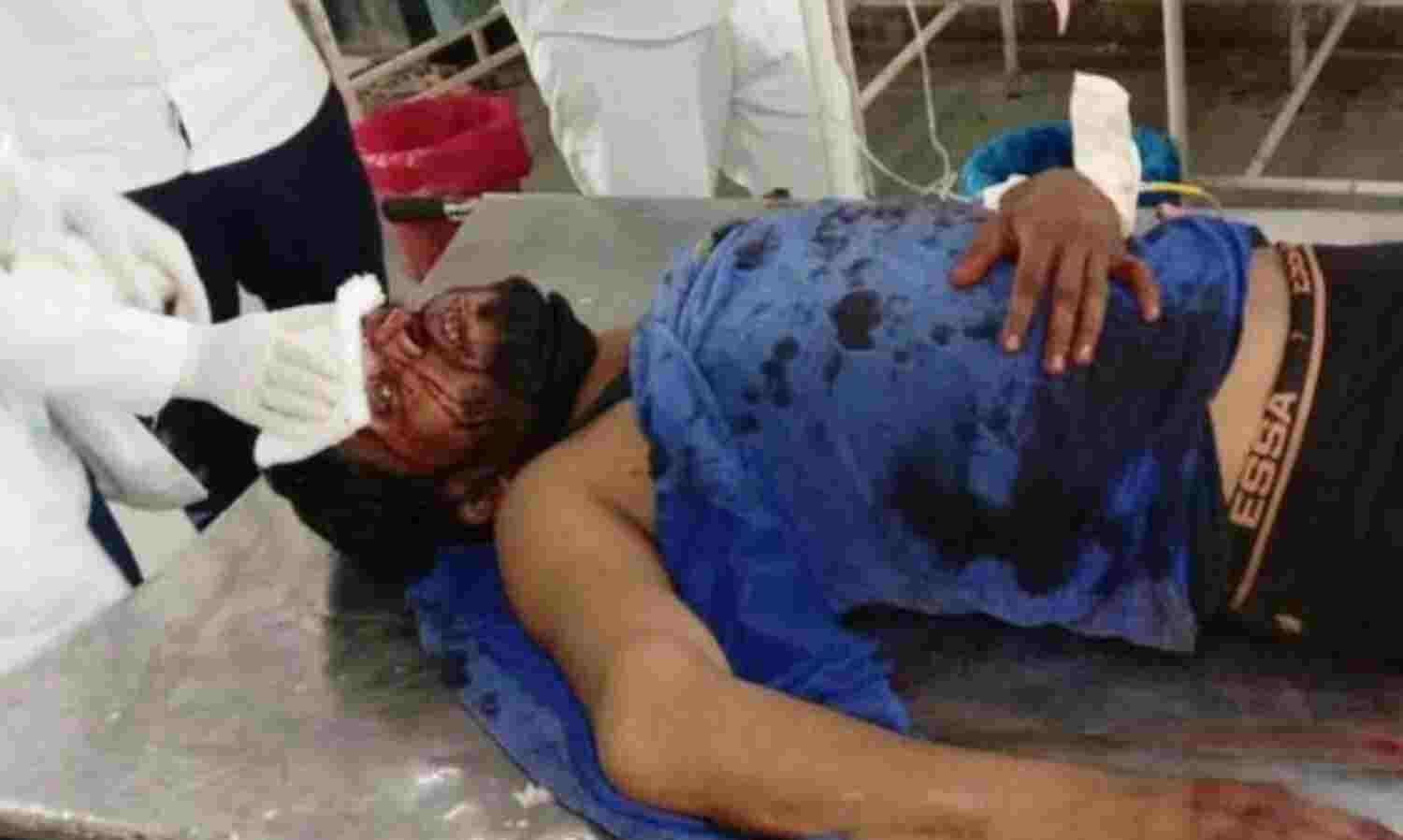 पुरानी रंजिश के चलते युवक पर कुल्हाड़ी से हमला, आरोपी फरार