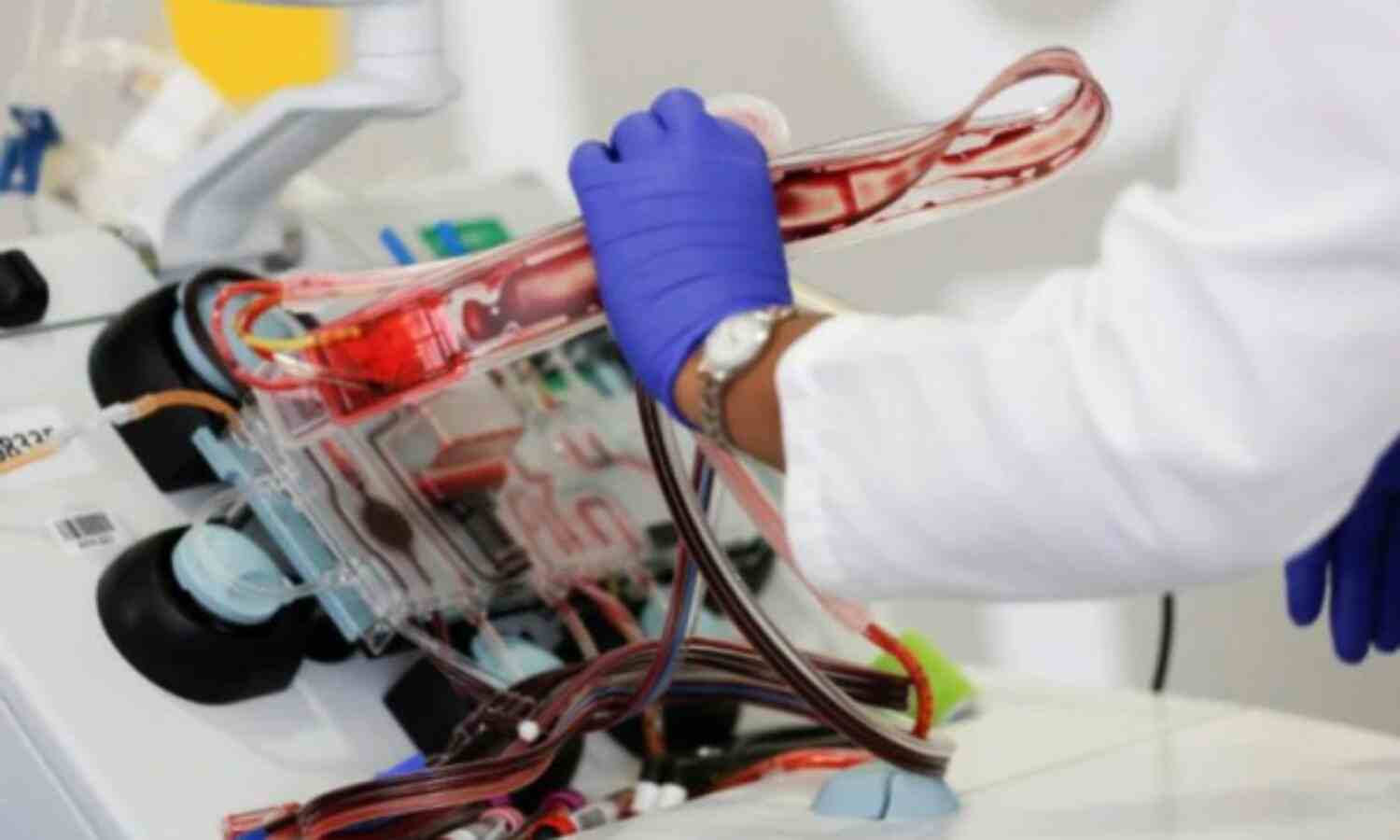 आईसीएमआर ने प्लाज्मा थेरेपी को लेकर एक नई एजवाइजरी जारी की