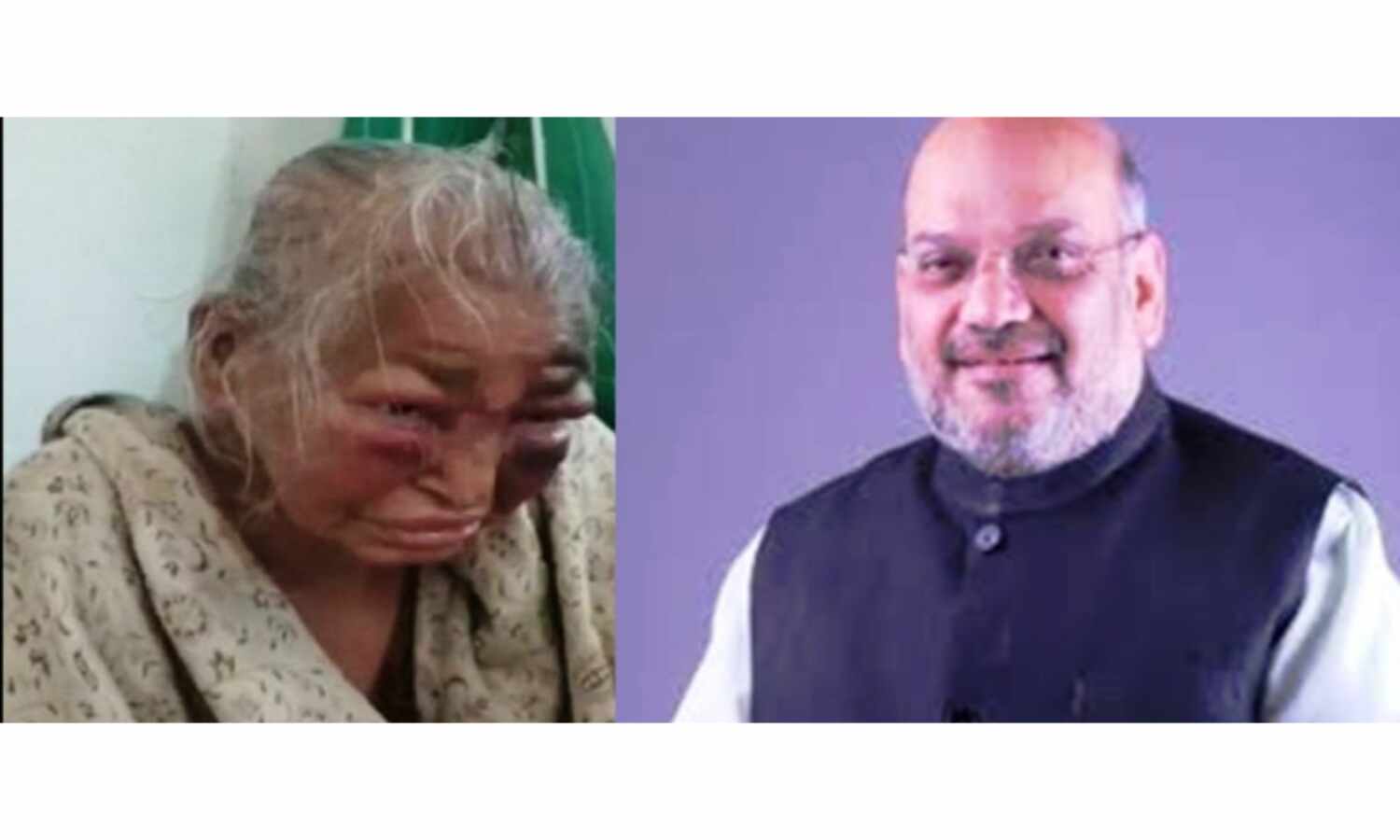 तृणमूल के हमले में घायल वृद्धा की मौत, अमित शाह ने जताया दुःख