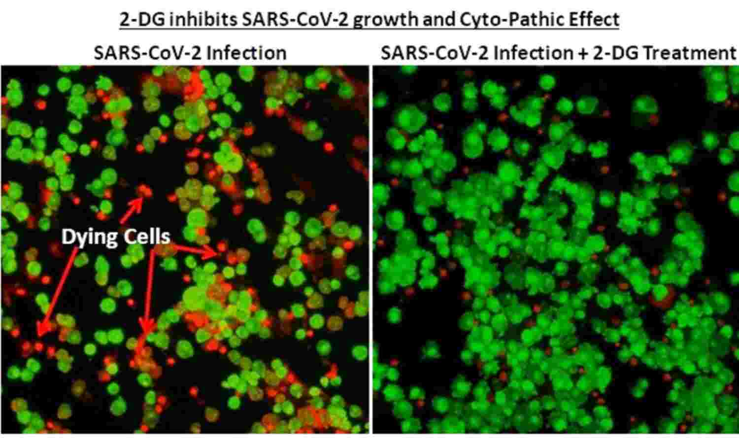राहत भरी खबर : ड्रग कंट्रोलर ने कोरोना की नई दवा को दी मंजूरी, DRDO ने की तैयार