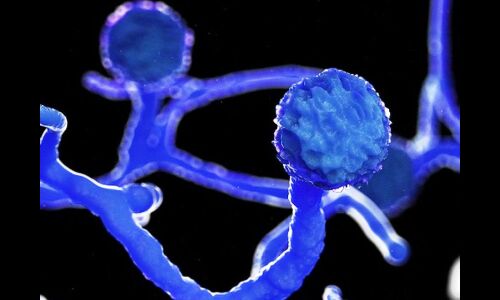 देश भर में ब्लैक फंगस के 2500 मरीज आए सामने, महाराष्ट्र में 1500 से अधिक