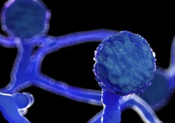 कोरोना वायरस के संक्रमण के बाद अब ब्लैक फंगस का हमला