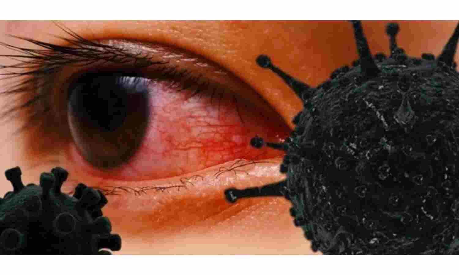 ब्लैक फंगस की दवा एम्फोटेरिसिन बी के उत्पादन के लिए 5 कंपनियों को मिला लाइसेंस