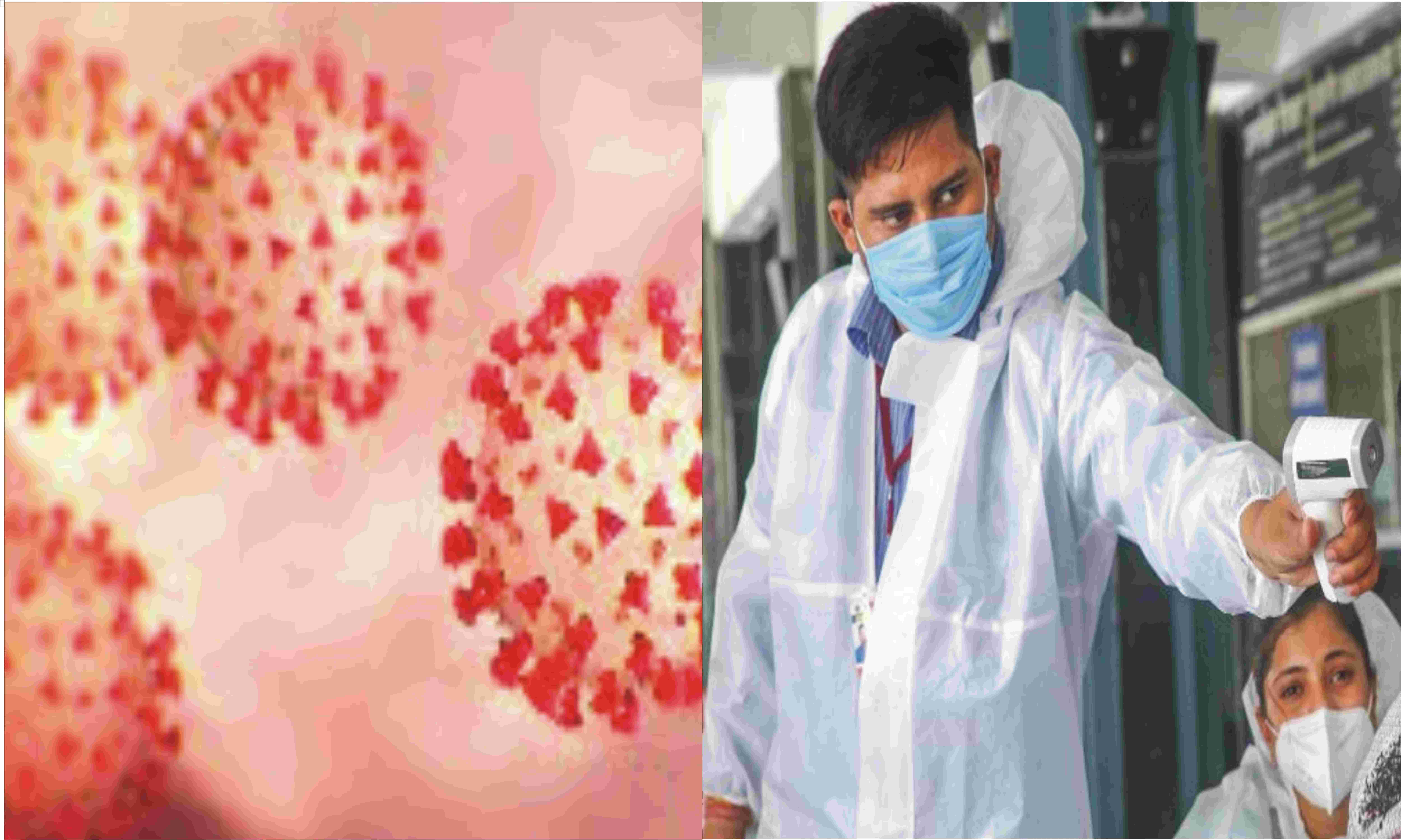 देश में फिर बढ़े कोरोना संक्रमित, बीते 39 दिन में सर्वाधिक मौत