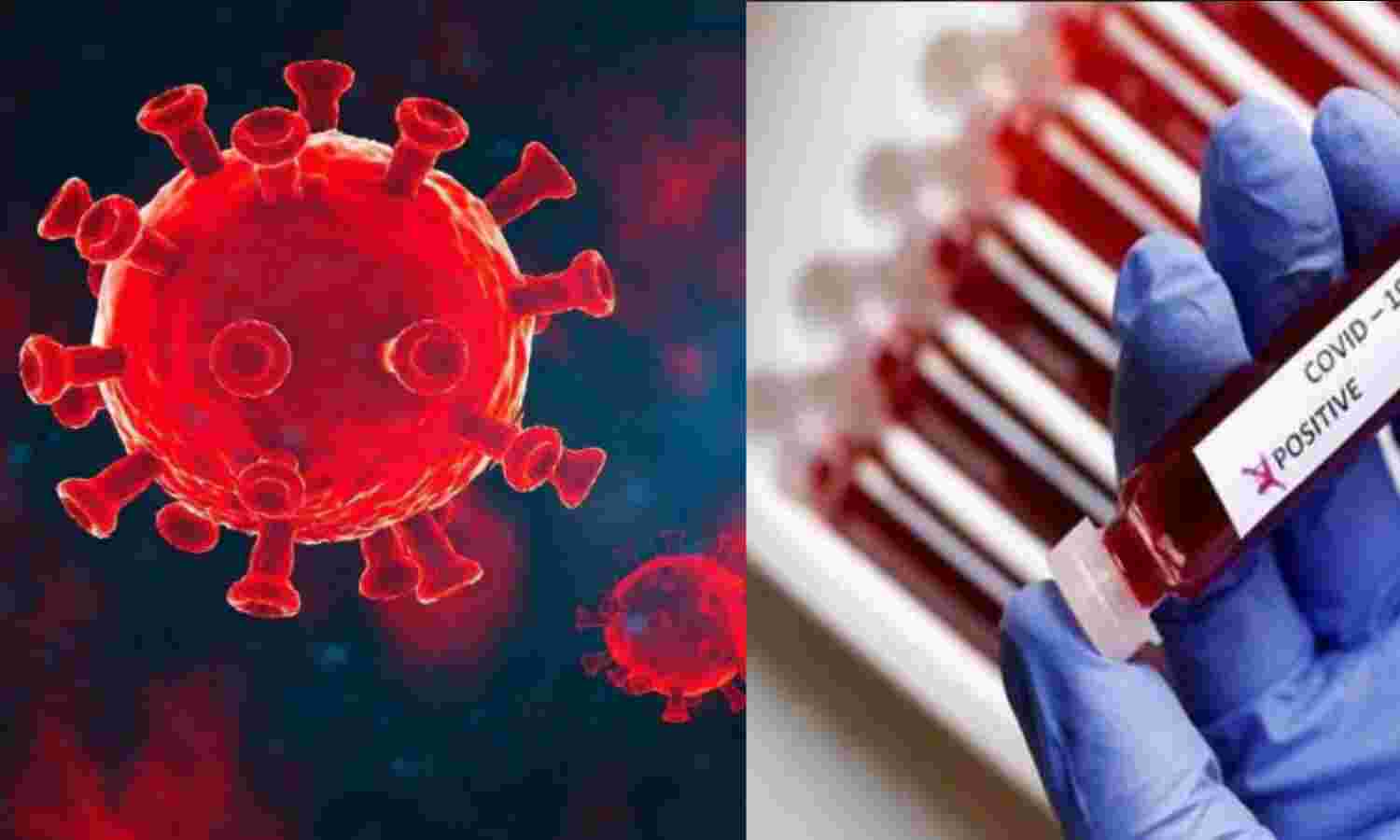 कोरोना संक्रमितों की संख्या में फिर बढ़ोत्तरी, 37 हजार, 593 नए मरीज