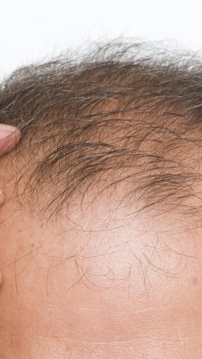 रोज सिर में तेल लगाने से होते है अनेक फायदे, आयुर्वेद करता है सिफारिश