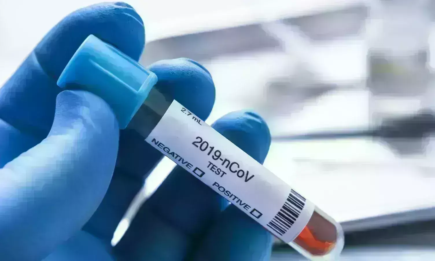 24 घंटों में कोरोना के 20 हजार से अधिक मरीज मिले, 44 संक्रमितों ने तोड़ा दम