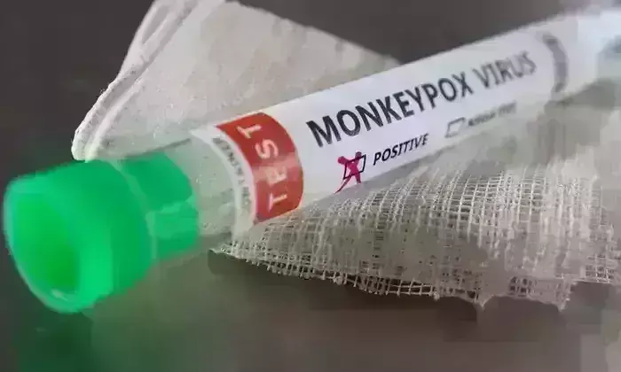 दिल्ली में मंकी पॉक्स का तीसरा मरीज मिला, स्वास्थ्य मंत्री ने कहा- देश में बनेगी वैक्सीन