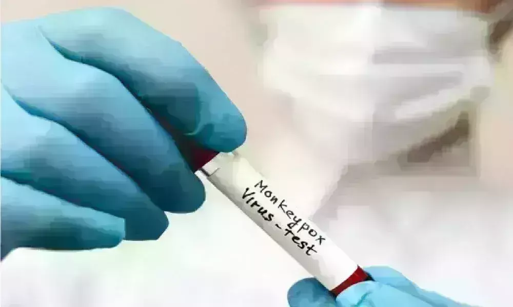 दिल्ली में मिला मंकी पॉक्स का पांचवां मरीज, अफ़्रीकी महिला मिली संक्रमित दिल्ली में मिला मंकी पॉक्स का पांचवां मरीज, अफ़्रीकी महिला मिली संक्रमित
