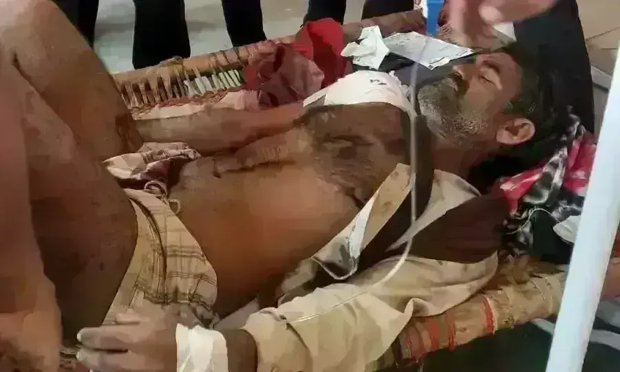 मुरैना में पानी को लेकर भाइयों में विवाद, ताबड़तोड़ चली गोलियां, एक घायल