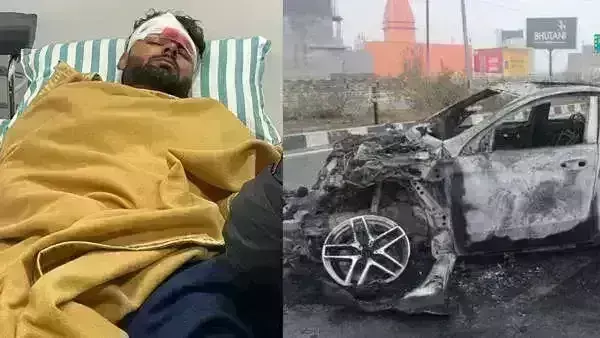 ऋषभ पंत अब खतरे से बाहर,  BCCI ने बताया - माथे पर कट, पैर में फ्रेक्चर