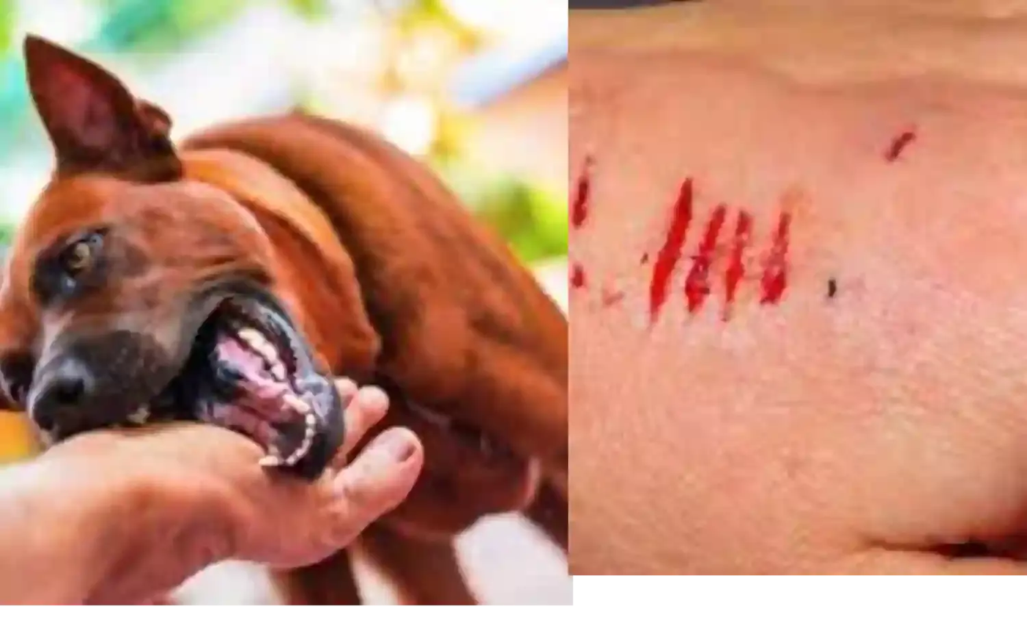 ग्वालियर में डॉग बीटिंग के मामलों में बढ़ोत्तरी, माह में 2 हजार से अधिक लोगों को काटा