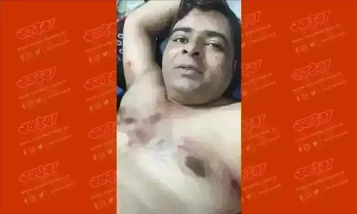 वर्चस्व की लडाई में ठेकेदार पर बरसाई ताबड़तोड़ गोलियां