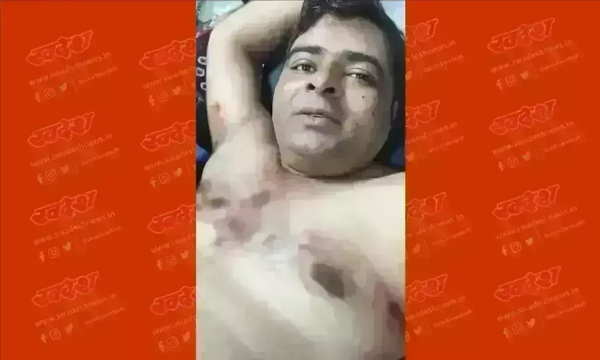 वर्चस्व की लडाई में ठेकेदार पर बरसाई ताबड़तोड़ गोलियां