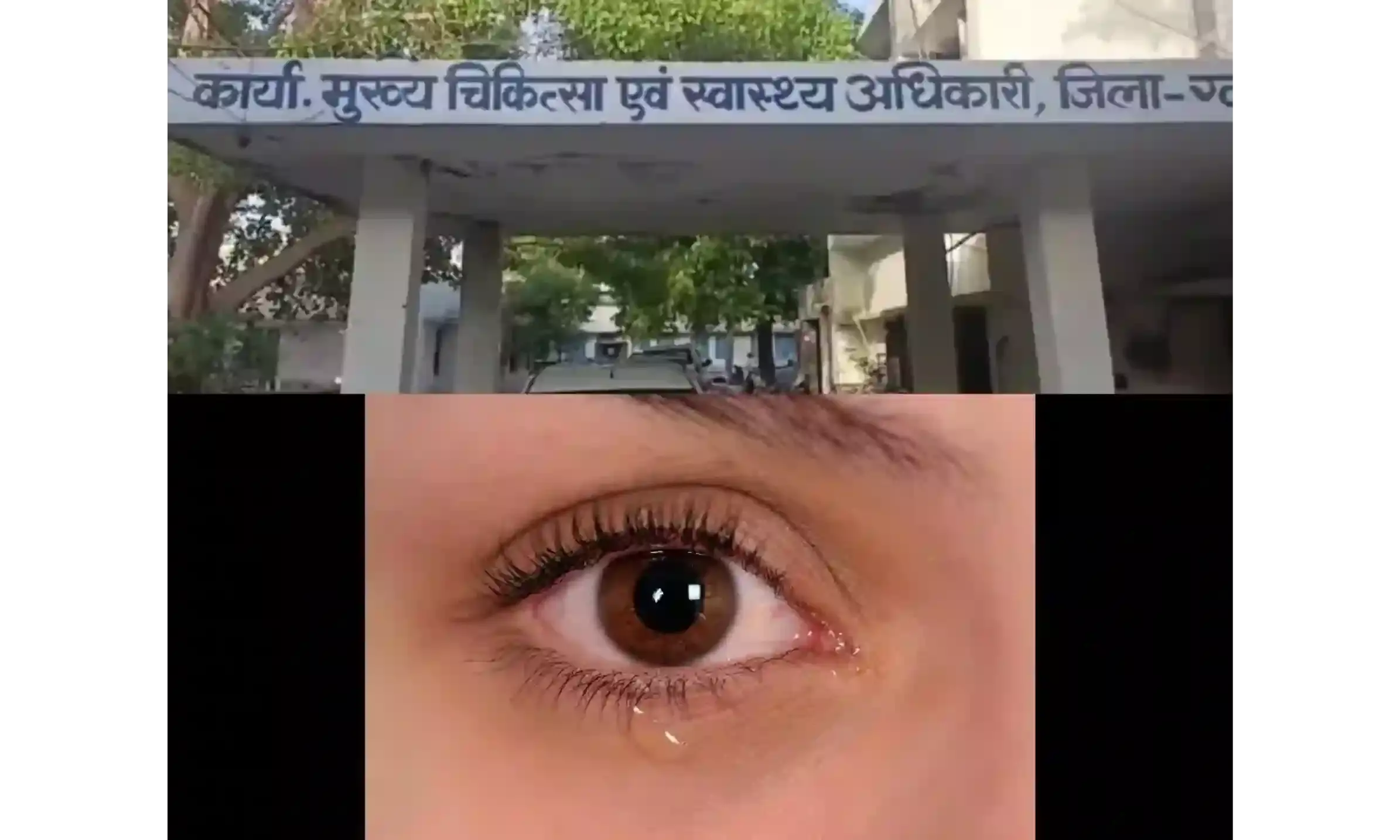 ग्वालियर में आई फ्लू को लेकर स्वास्थ्य विभाग ने जारी की गाइड लाइन