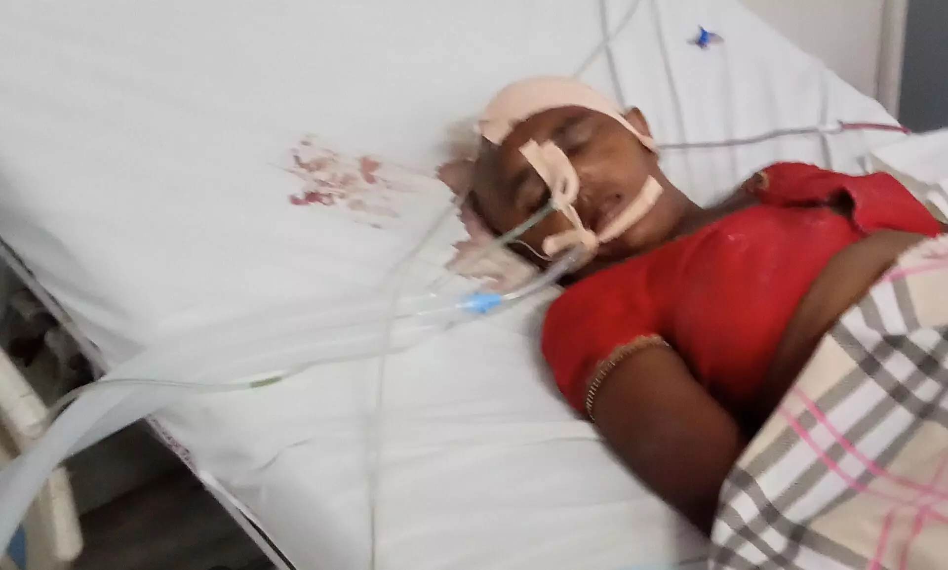 सिविल अस्पताल अमरपाटन में निर्माणाधीन भवन से महिला के ऊपर गिरी ईट फटा सिर