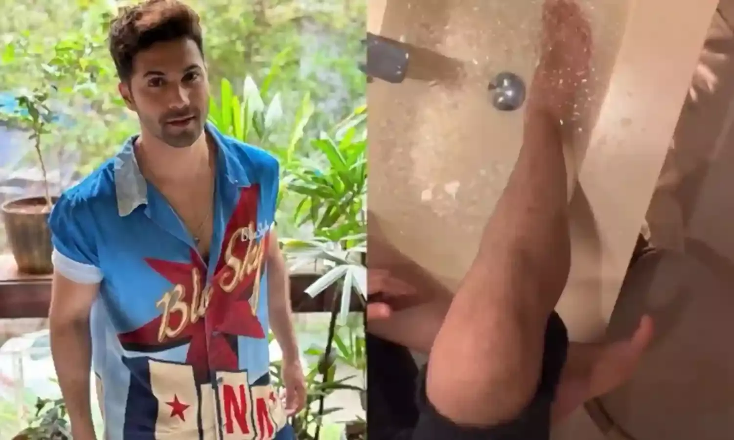 शूटिंग के दौरान घायल हुए वरुण धवन