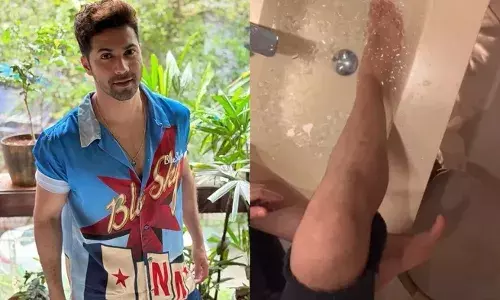 शूटिंग के दौरान घायल हुए वरुण धवन