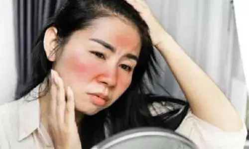 त्वचा जल गयी त्वरित राहत के लिए प्रभावी आयुर्वेदिक उपचार खोजें