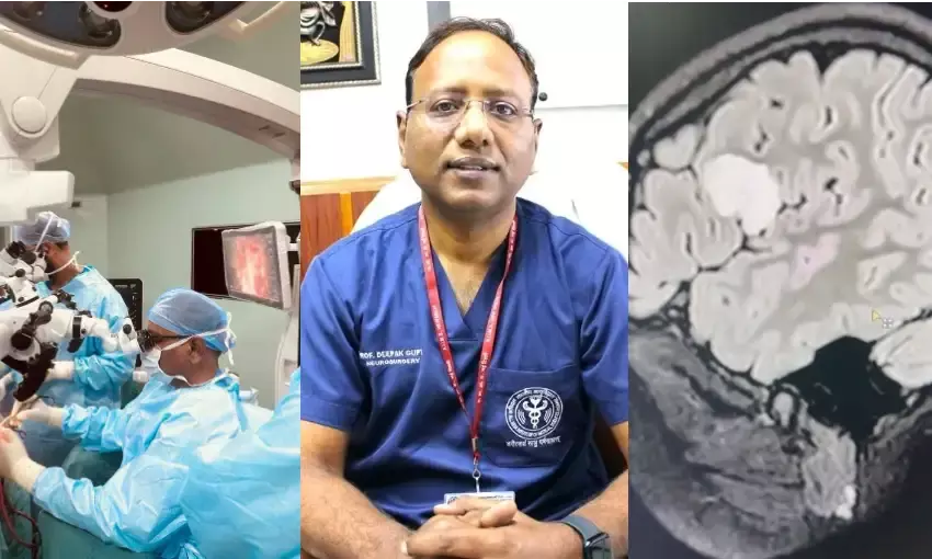 AIIMS के डॉक्टरों का कमाल, सिर खोलकर करते रहे सर्जरी, बच्ची मुस्कराकर देती रही जवाब AIIMS के डॉक्टरों का कमाल, सिर खोलकर करते रहे सर्जरी, बच्ची मुस्कराकर देती रही जवाब