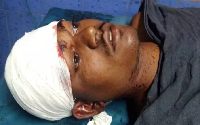 खड़दह में क्रिकेट प्रतियोगिता में झगड़े में बंदूक के बट से युवक का सिर फोड़ा