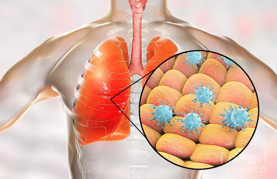जानिए कोविद -19 और निमोनिया के लक्षण और इससे बचाव के कारगर