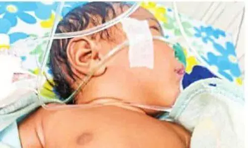 शहडोल में फिर हैवानियत, दागने से 2 माह की बच्ची की हालत गंभीर, निमोनिया से पीड़ित अबोध को गर्म सलाखों से दागा