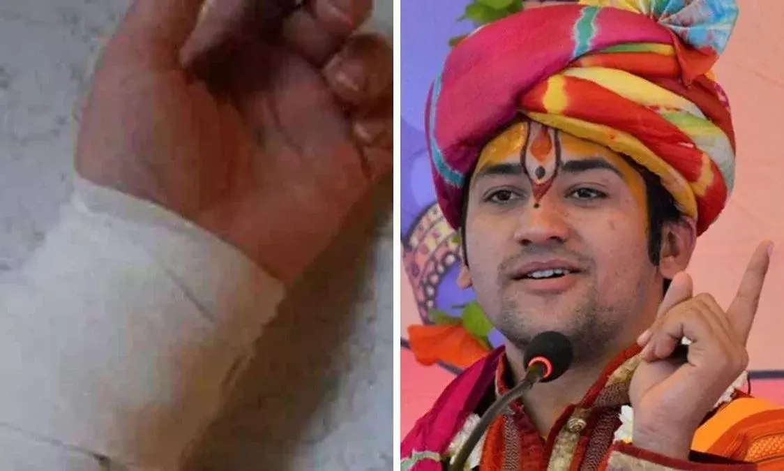 बागेश्वर सरकार से मिलने की जिद में महिला ने काटी हाथ की नस, हालत गंभीर