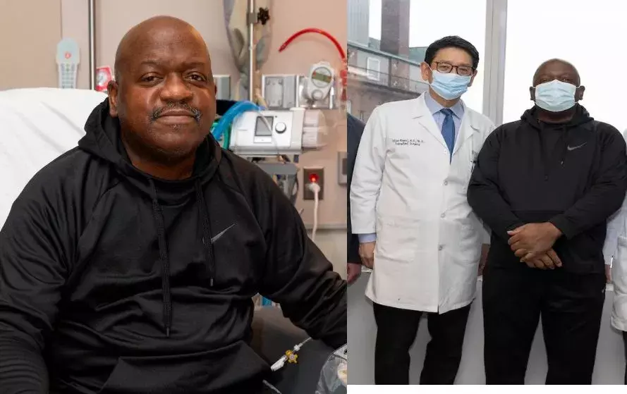 Pig Kidney Transplant: कौन था वो आदमी जिसनें करवाई सुअर की किडनी ट्रॉन्सप्लांट, फिर हो गई अचानक मौत, ये बड़ी वजह आई सामने