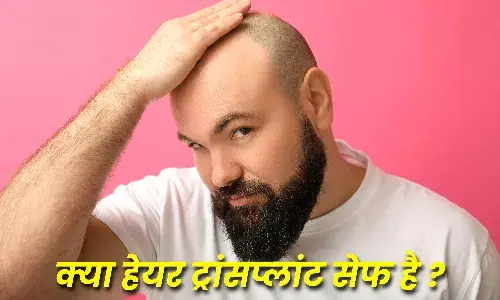 Hair Transplant: हेयर ट्रांसप्लांट करवाना चाहते हैं तो जान लें यह महत्‍वपूर्ण बातें...