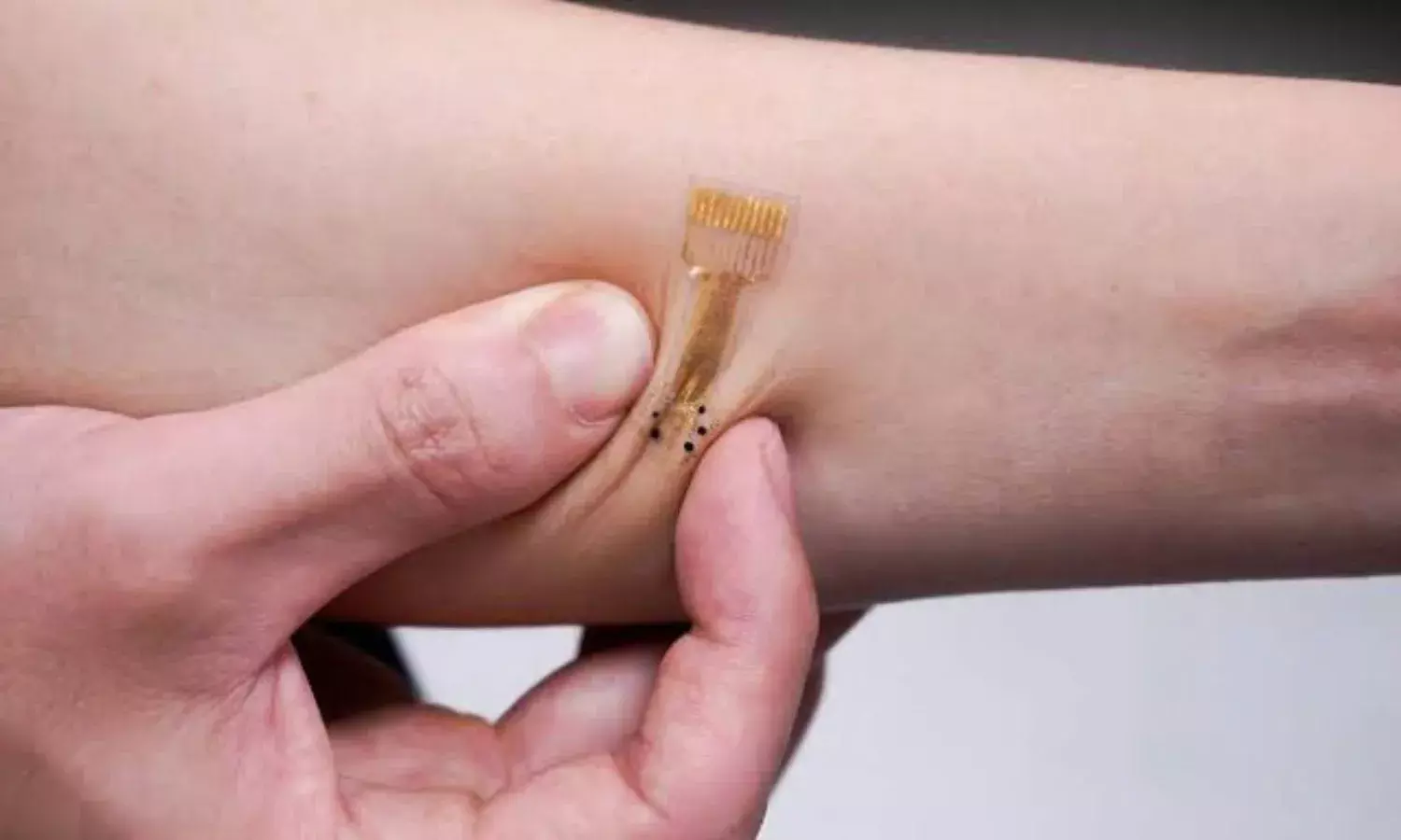 अब कटने या जलने पर तुरंत आराम देंगी स्मार्ट बैंडेज, जानिए कैसे करती है काम