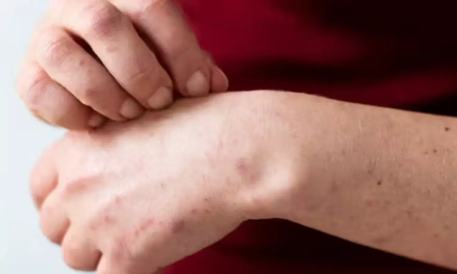 Tree Man Disease: शरीर के अंगों में उभरने लगती है पेड़ों के तने की तरह संरचना, जानिए