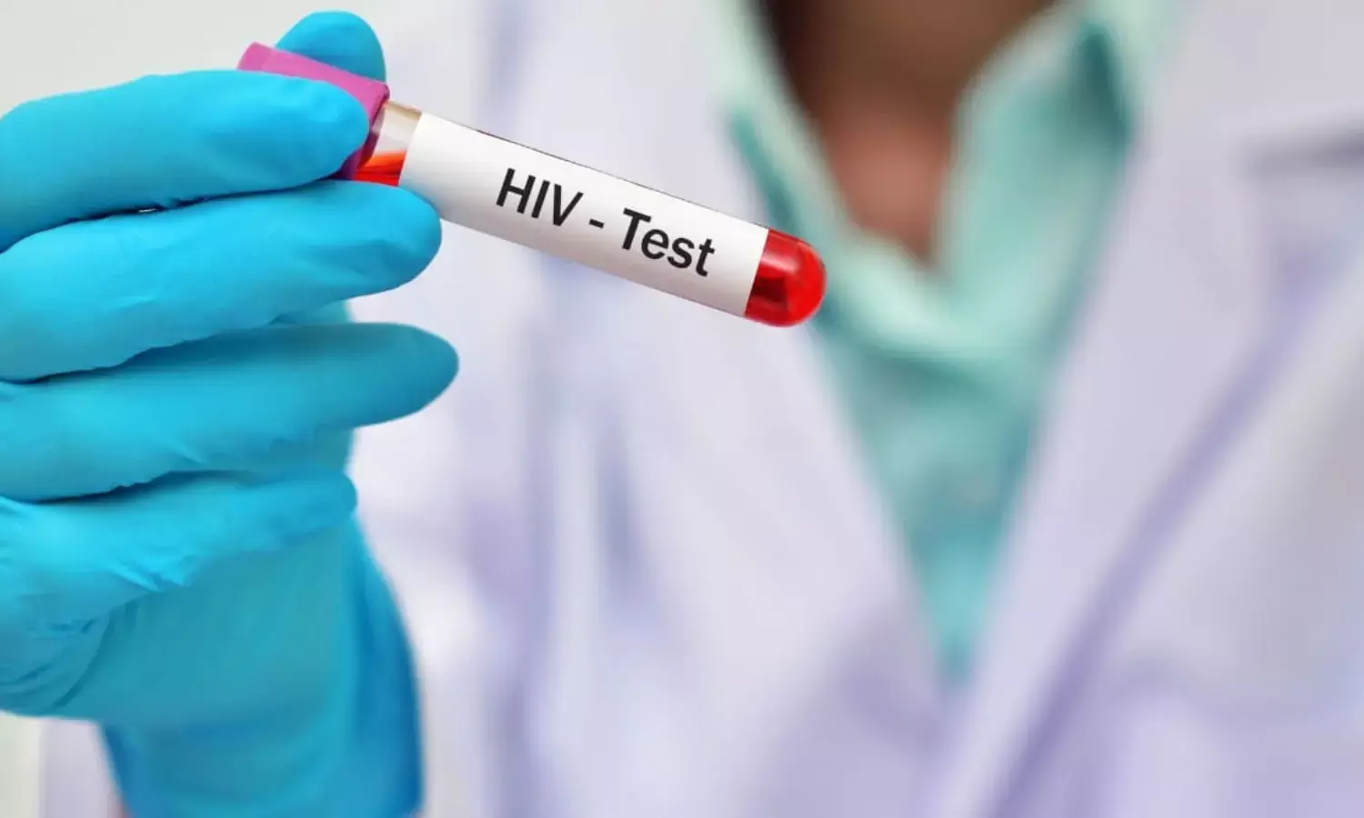 Tripura Students HIV: भारत के इस राज्य में 828 छात्र पाए गए HIV पॉजिटिव, 47 की मौत