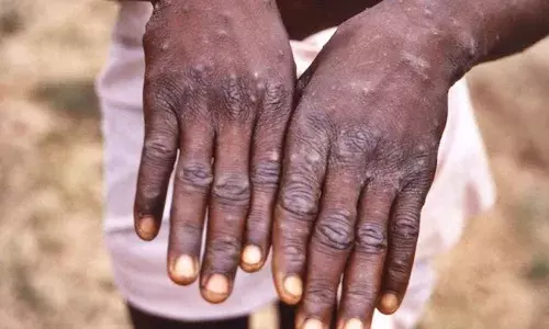 WHO ने दूसरी बार घोषित की पब्लिक हेल्थ इमरजेंसी