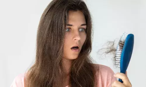 एलोवेरा और प्याज के रस से बालों का झड़ना रोकने के आसान तरीके