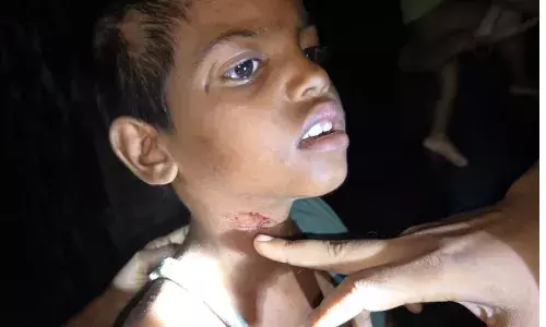 नहीं थम रहे भेड़िए के हमले, अब 5 साल की बच्ची को बनाया निशाना, खौफ में ग्रामीण