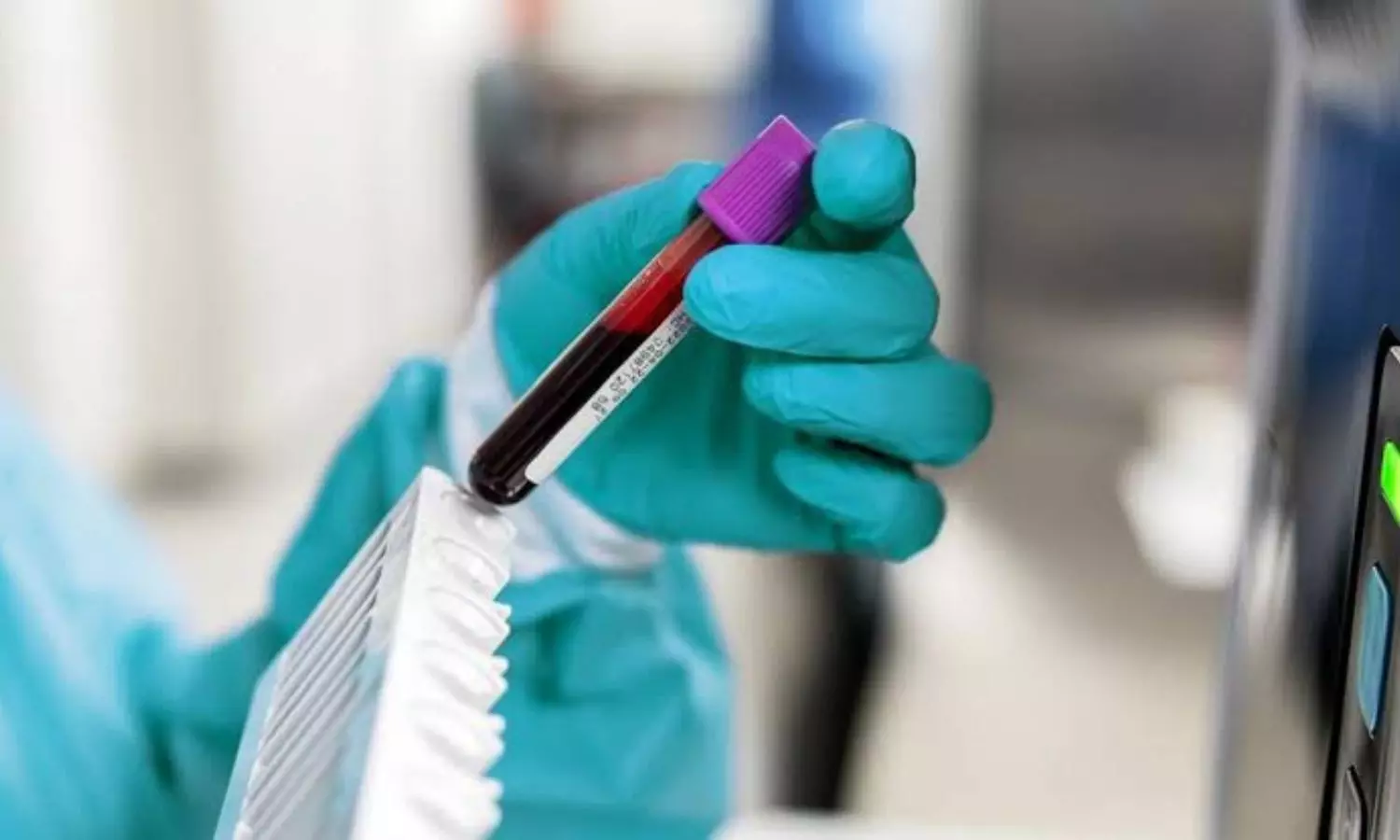 आ गई कैंसर का पता लगाने वाली डिवाइस, जानिए कैसे करती है काम और उसकी कीमत आ गई कैंसर का पता लगाने वाली डिवाइस, जानिए कैसे करती है काम और उसकी कीमत