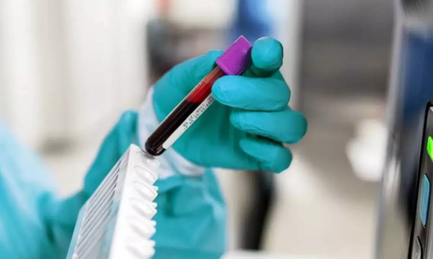 आ गई कैंसर का पता लगाने वाली डिवाइस, जानिए कैसे करती है काम और उसकी कीमत आ गई कैंसर का पता लगाने वाली डिवाइस, जानिए कैसे करती है काम और उसकी कीमत